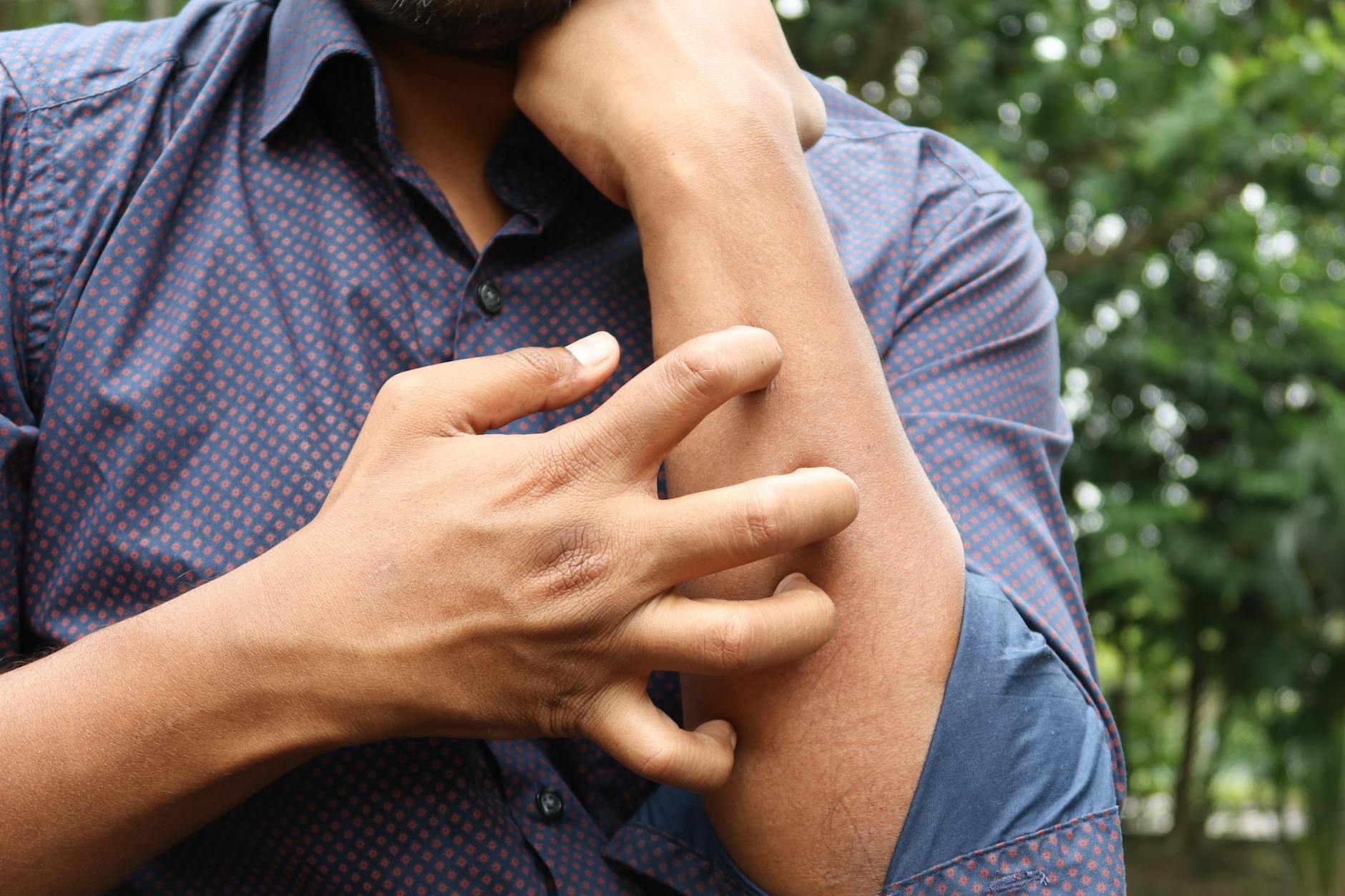 man scratching a hand