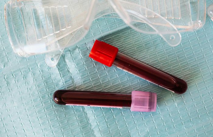 medical eyeglasses and full of blood vials on diaper